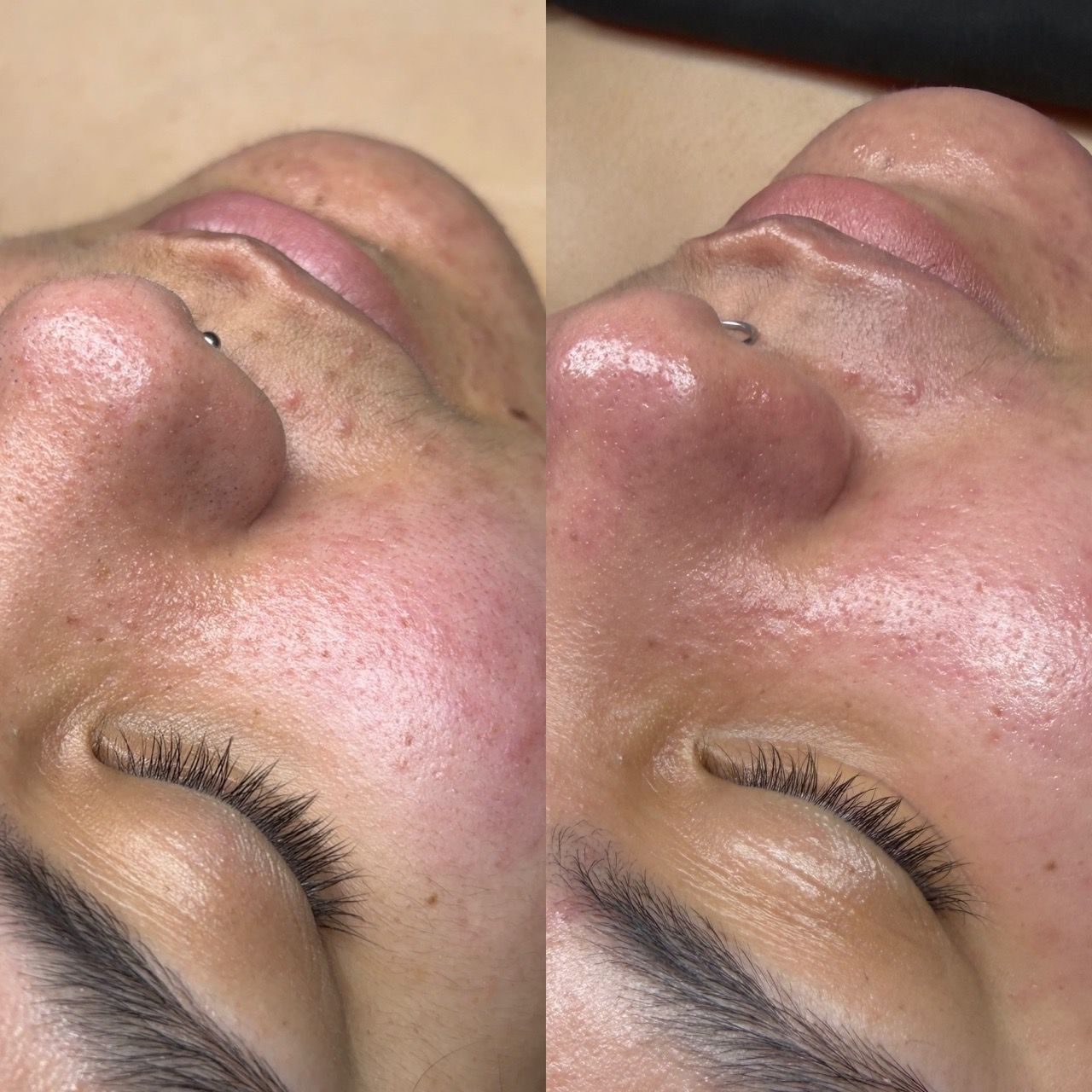  skincare,facial,beauty,comparison 
