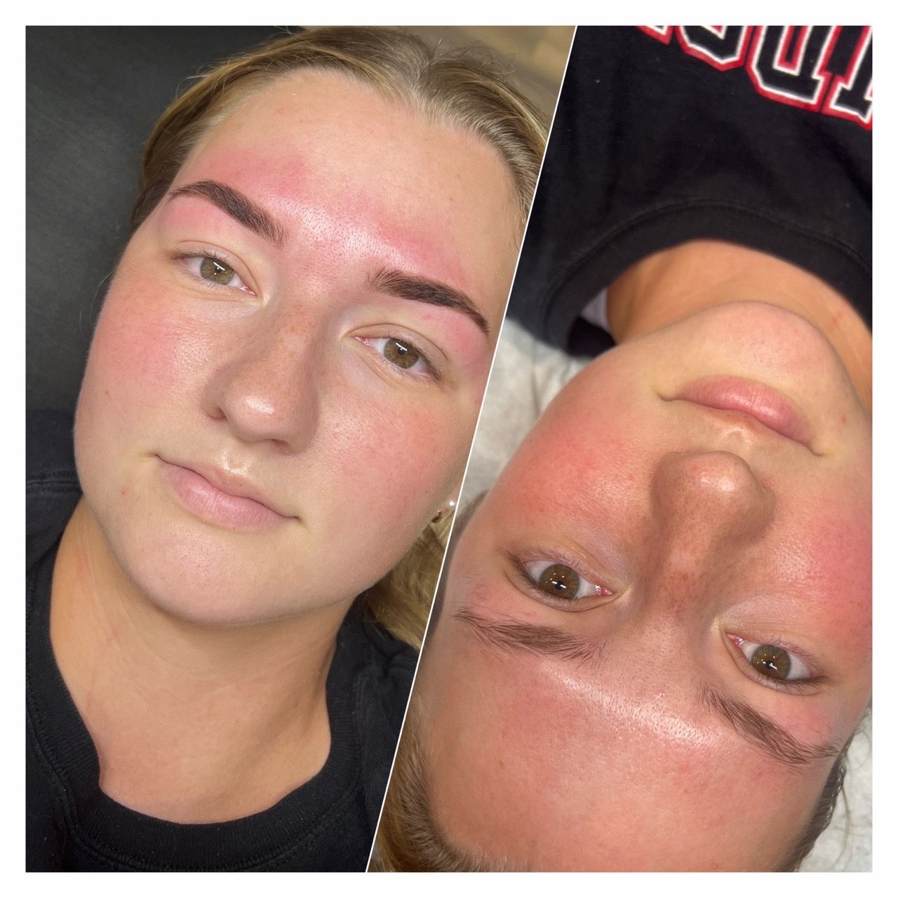  before-and-after,beauty-treatment,eyebrow,skin-care  