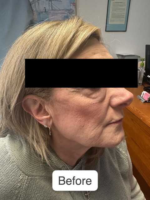 gallery image in our gallery