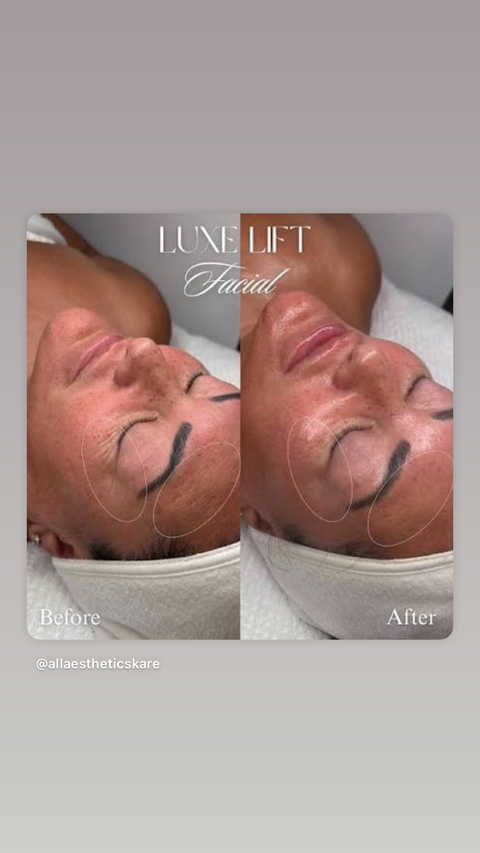 gallery image in our gallery