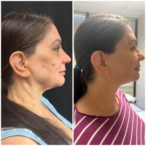 gallery image in our gallery