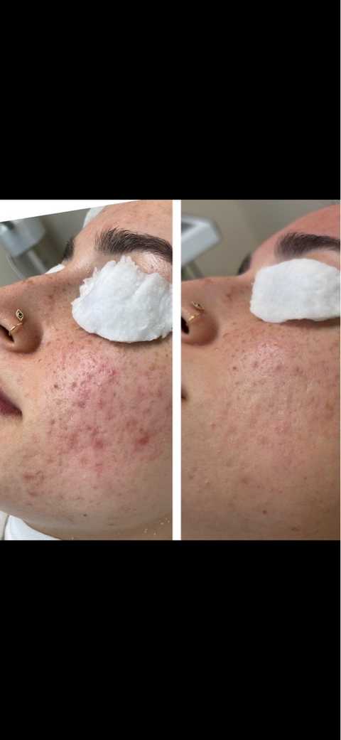 gallery image in our gallery