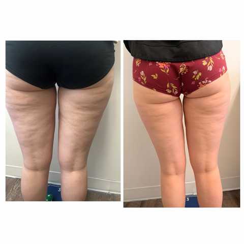 gallery image in our gallery