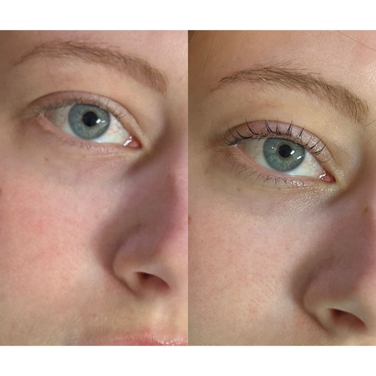  eye,eyebrow,skin,beauty,close-up,before-and-after  