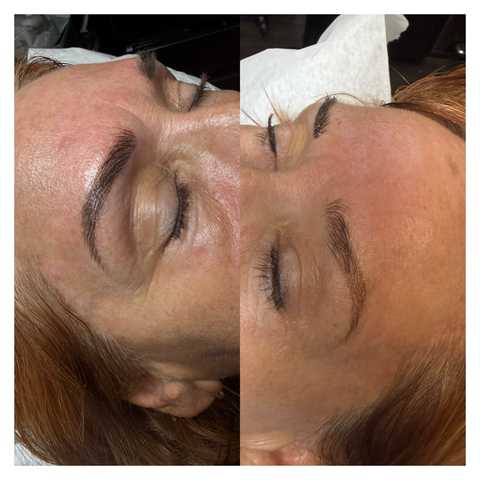 Eyebrow: Microblading