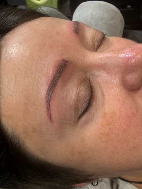 Eyebrow: Microblading