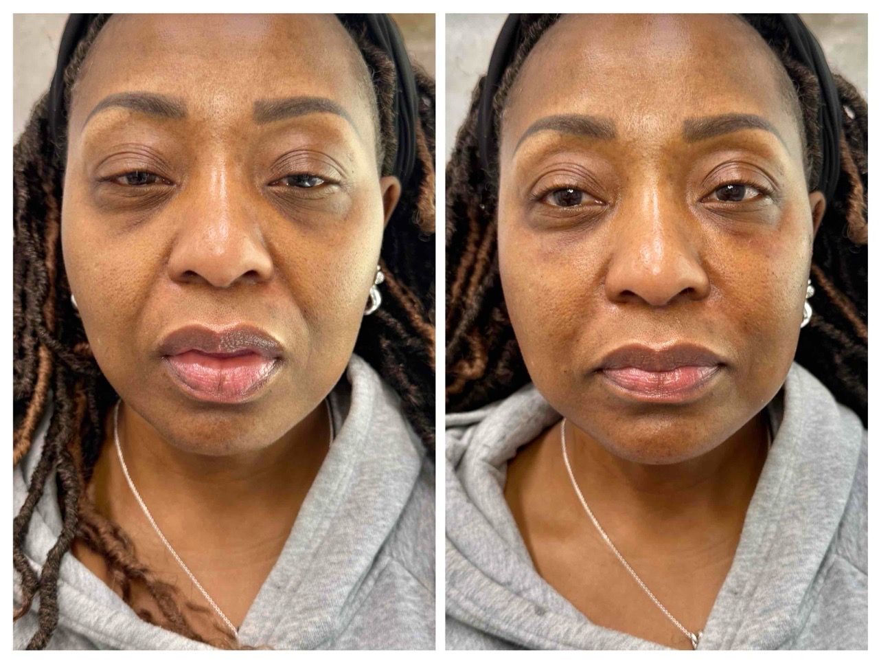  before and after,transformation,beauty service  