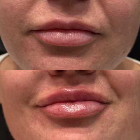 gallery image in our gallery