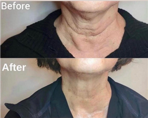 gallery image in our gallery