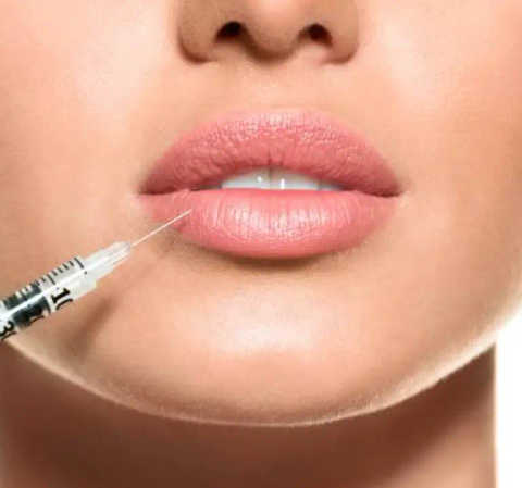 Lip Fillers 3mls
