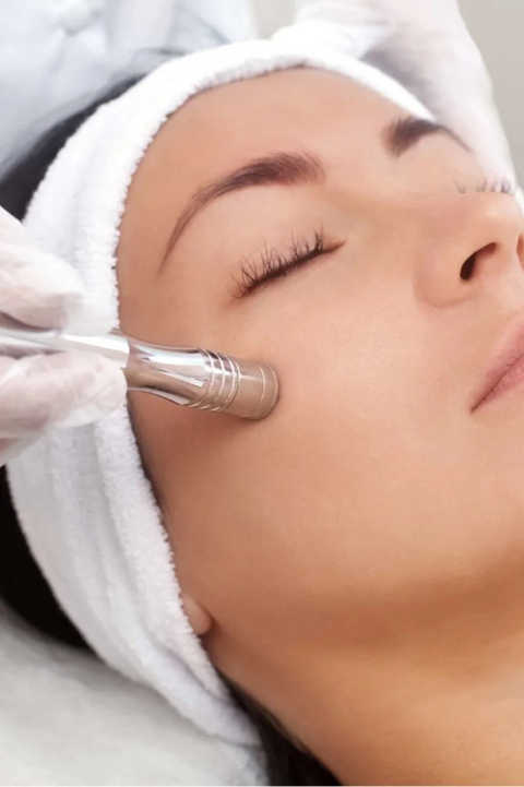 Dull, Rough Skin After Summer: Is Diamond Microdermabrasion Right? Image