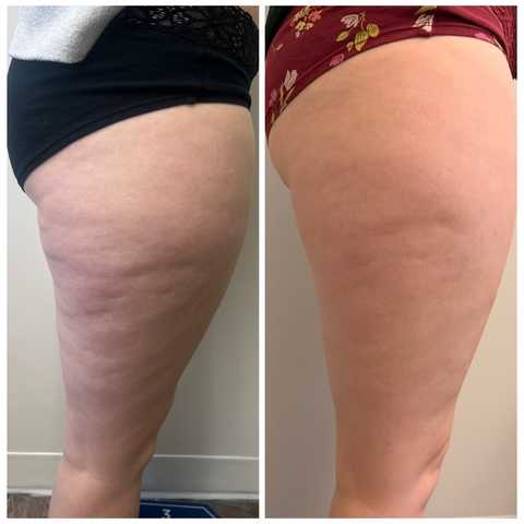 gallery image in our gallery