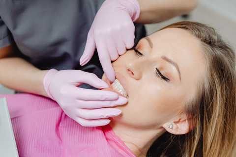Teeth Whitening service