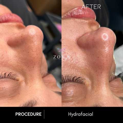 gallery image in our gallery