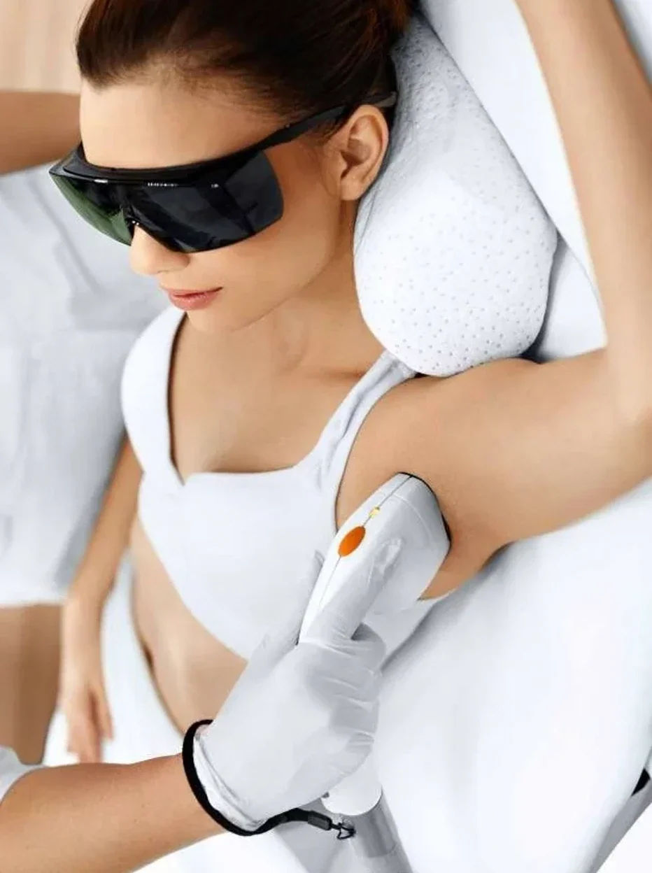 Laser Hair Removal