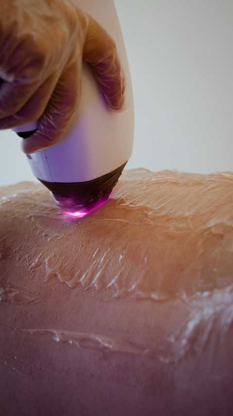Nose Laser Hair Removal