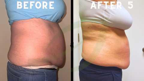 gallery image in our gallery