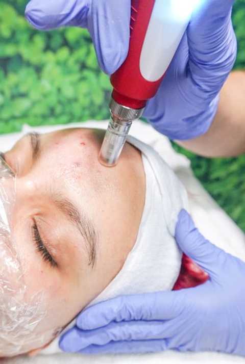 Hair Restoration service