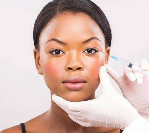 Microneedling