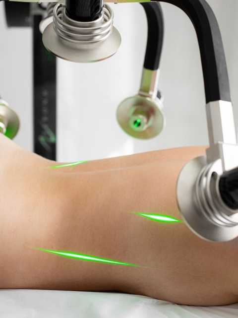 Snella Laser Lipo service