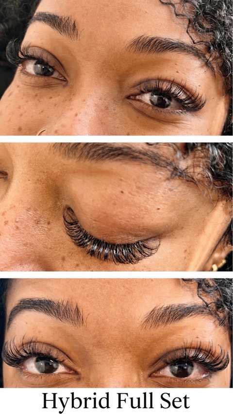Microneedling