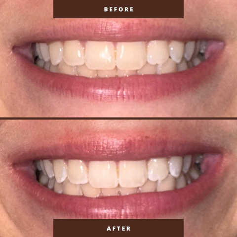 gallery image in our gallery