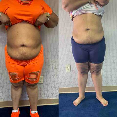 gallery image in our gallery