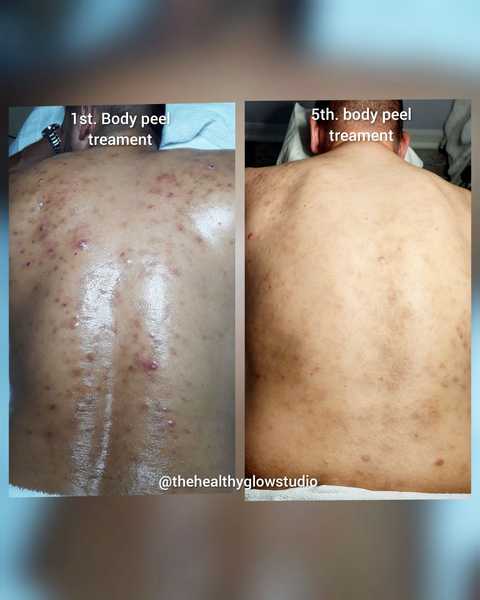 gallery image in our gallery