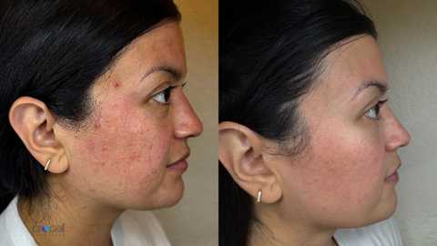 gallery image in our gallery