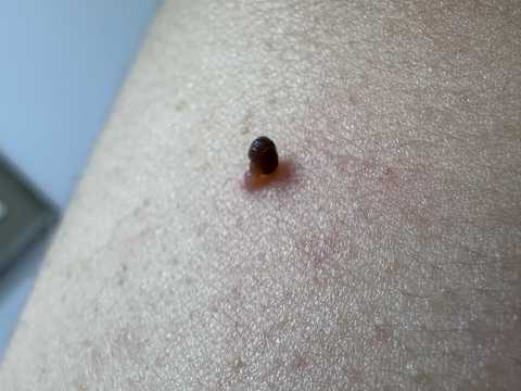 gallery image in our gallery