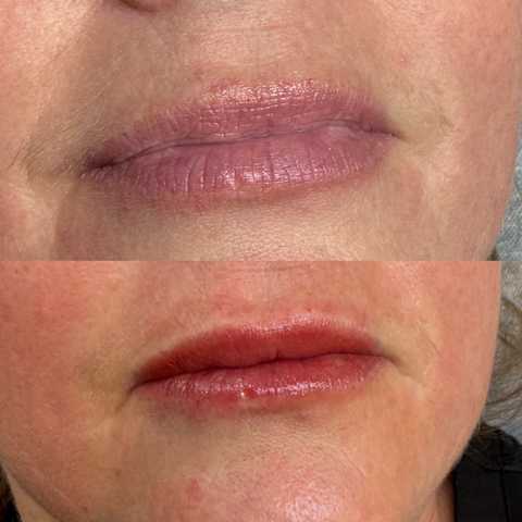 gallery image in our gallery