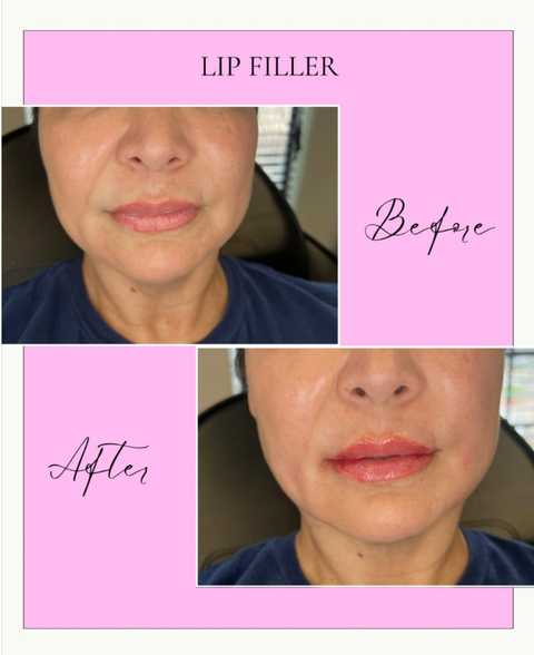 gallery image in our gallery