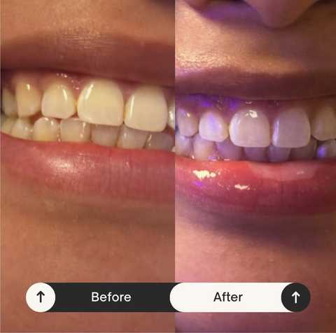 gallery image in our gallery