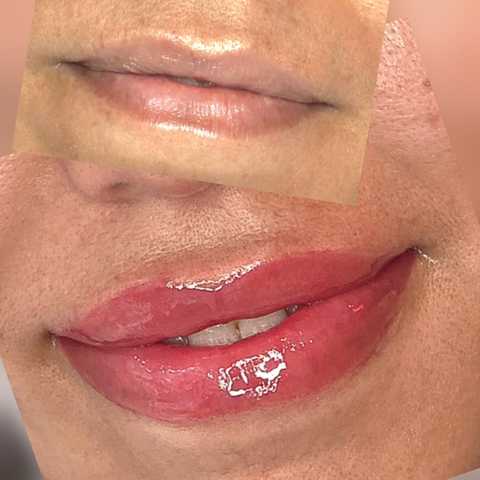 Lip Blushing
