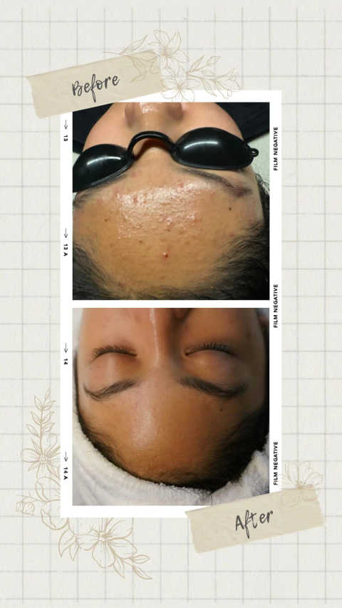 gallery image in our gallery