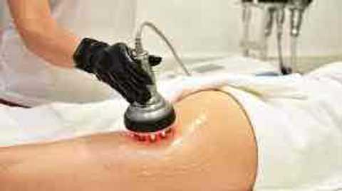 Skin Tightening RF