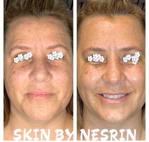 gallery image in our gallery