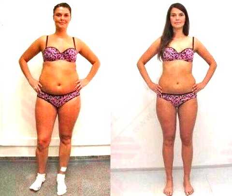 gallery image in our gallery