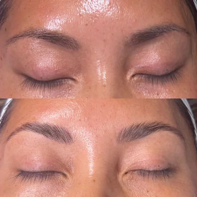 eyebrow,beauty treatment,before and after,cosmetic results