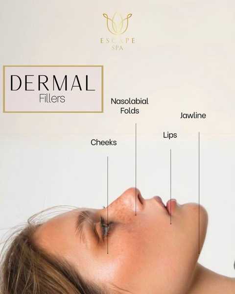 gallery image in our gallery