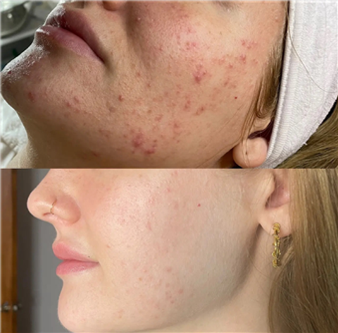 gallery image in our gallery