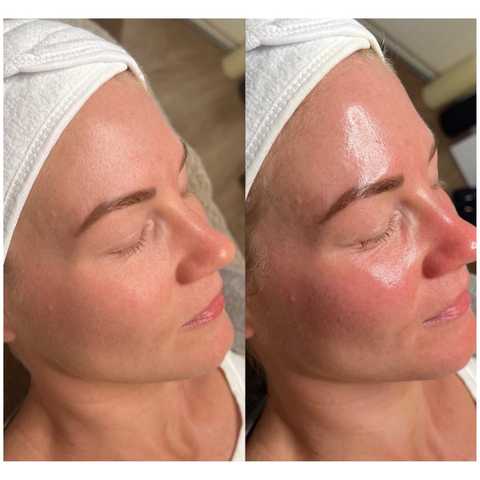 gallery image in our gallery