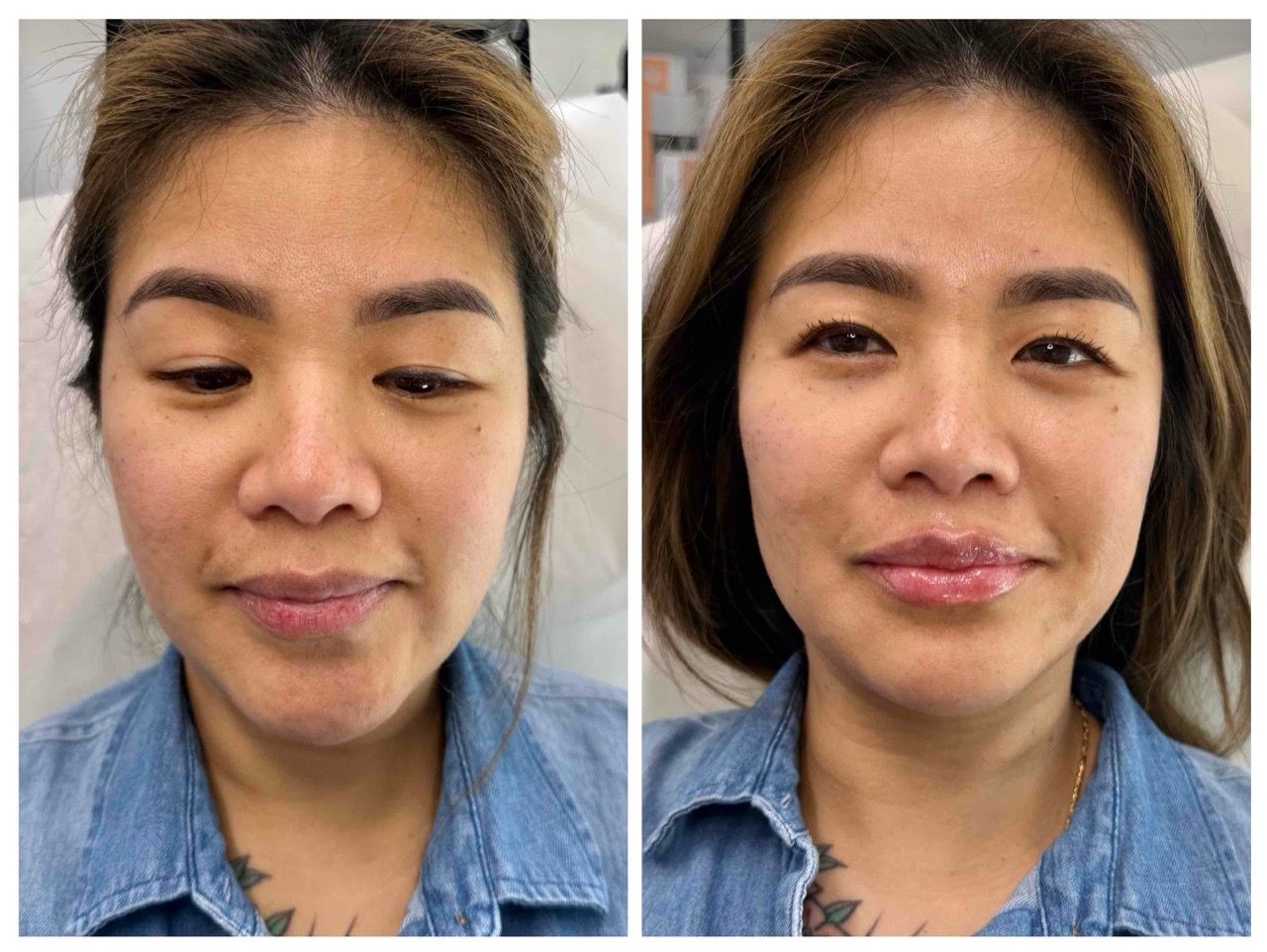 before and after,beauty,transformation,facial features