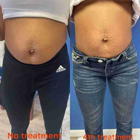 gallery image in our gallery