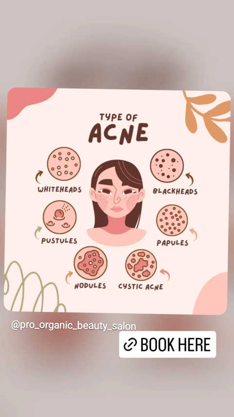 gallery image in our gallery