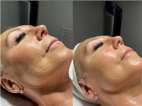 gallery image in our gallery