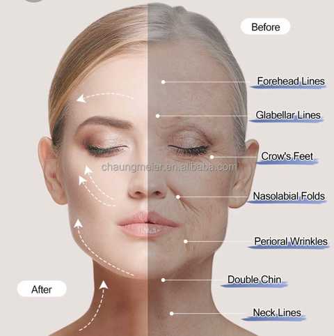 gallery image in our gallery