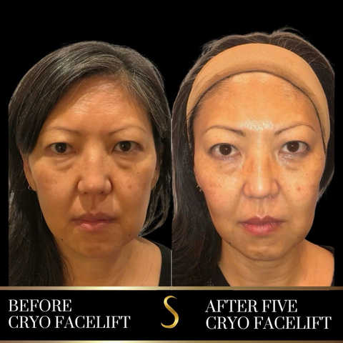 gallery image in our gallery