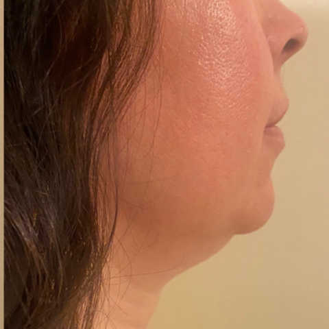 gallery image in our gallery