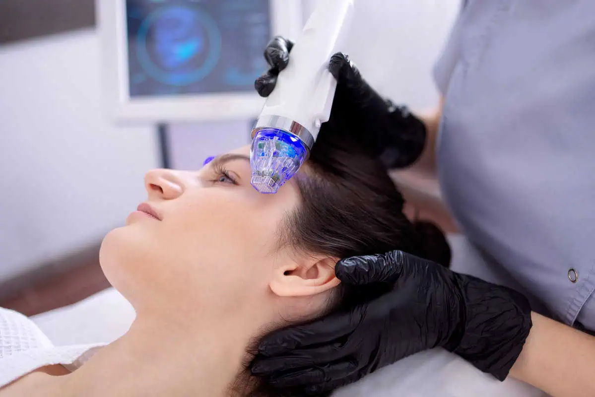 CO2 laser and RF Microneedling